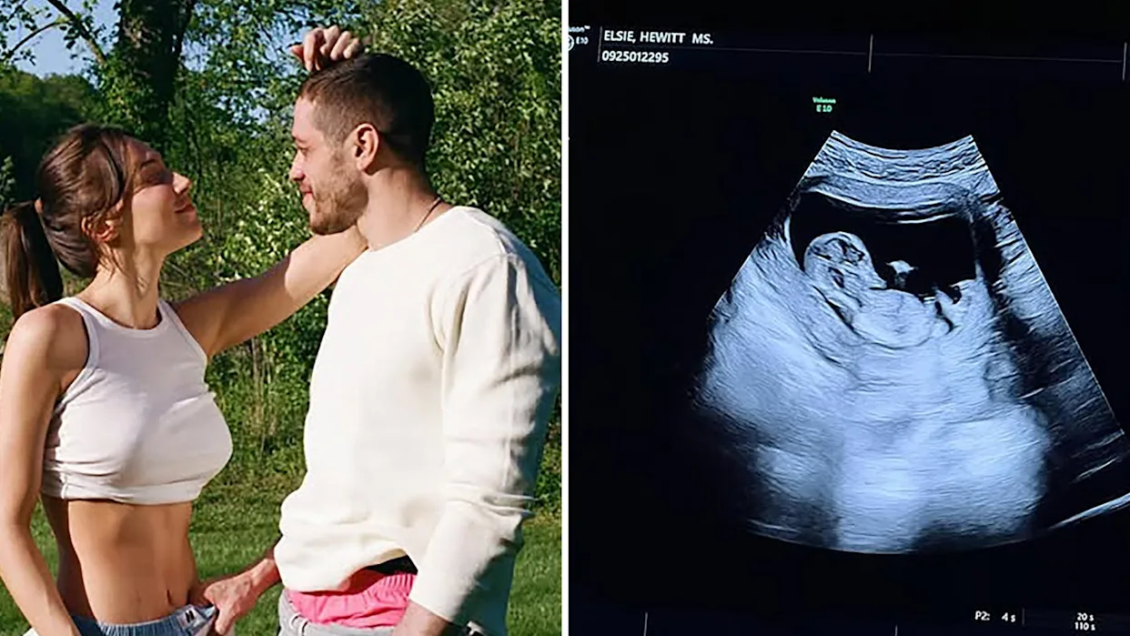 Elsie Hewitt unfiltered baby announcement photo