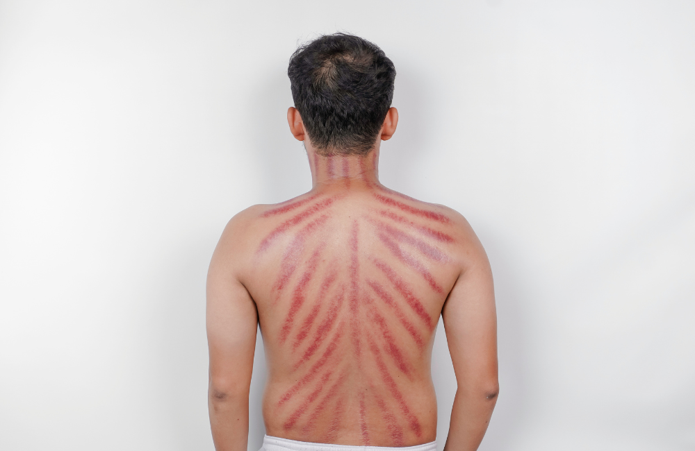 The Viral Indonesian Remedy for Cold Symptoms Naturally